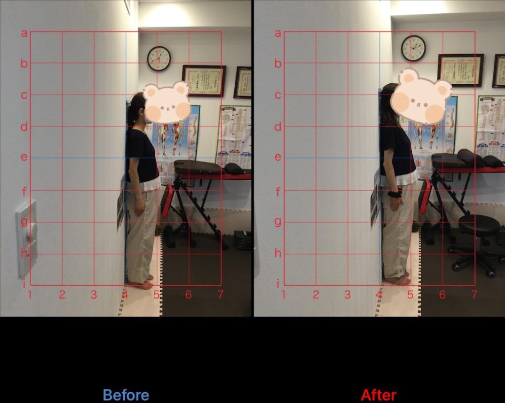 マタニティ整体でのビフォーアフターの写真