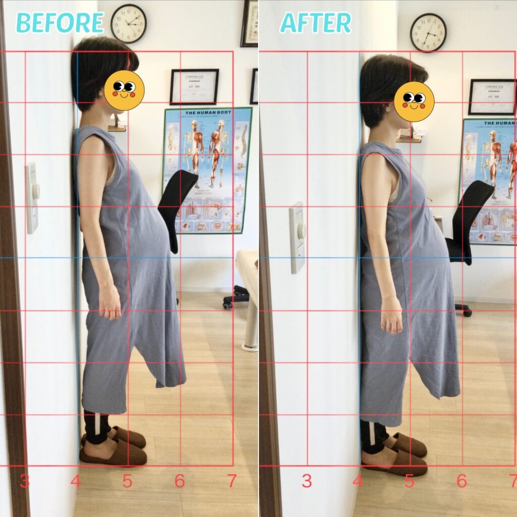 マタニティ整体before＆after