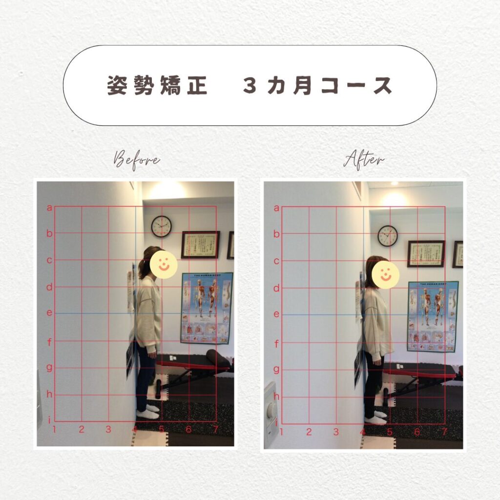 姿勢矯正3か月コース