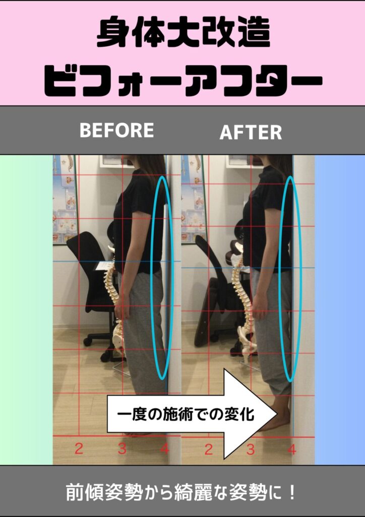 姿勢before&after