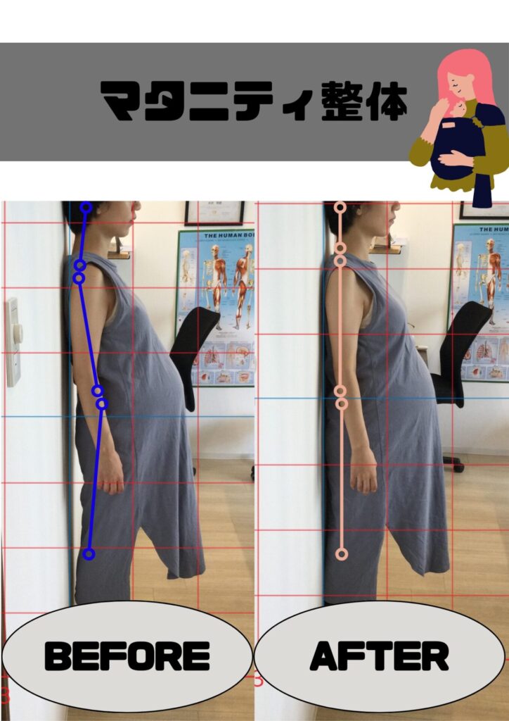 マタニティbefore&after