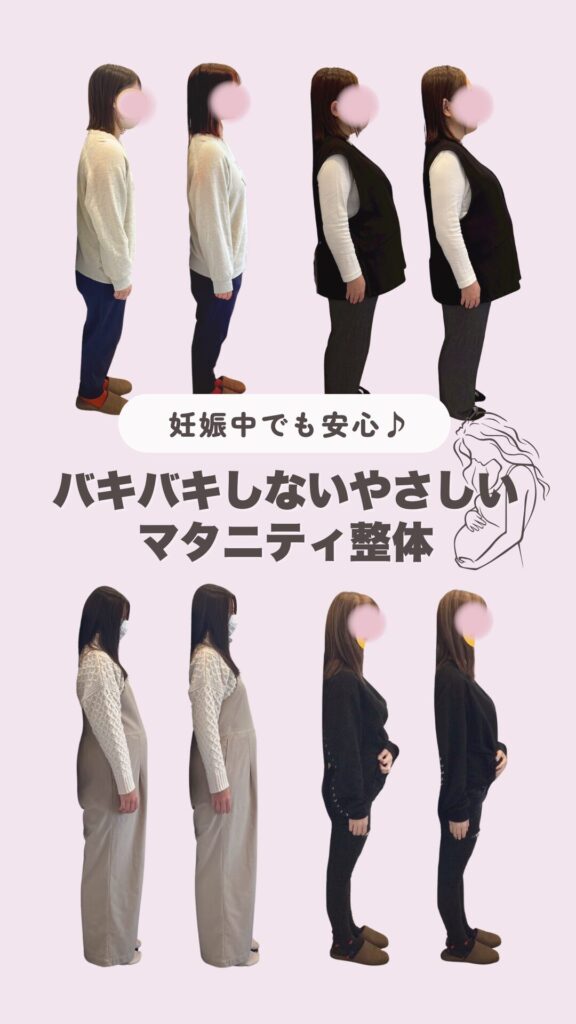 バキバキしないやさしいマタニティ整体