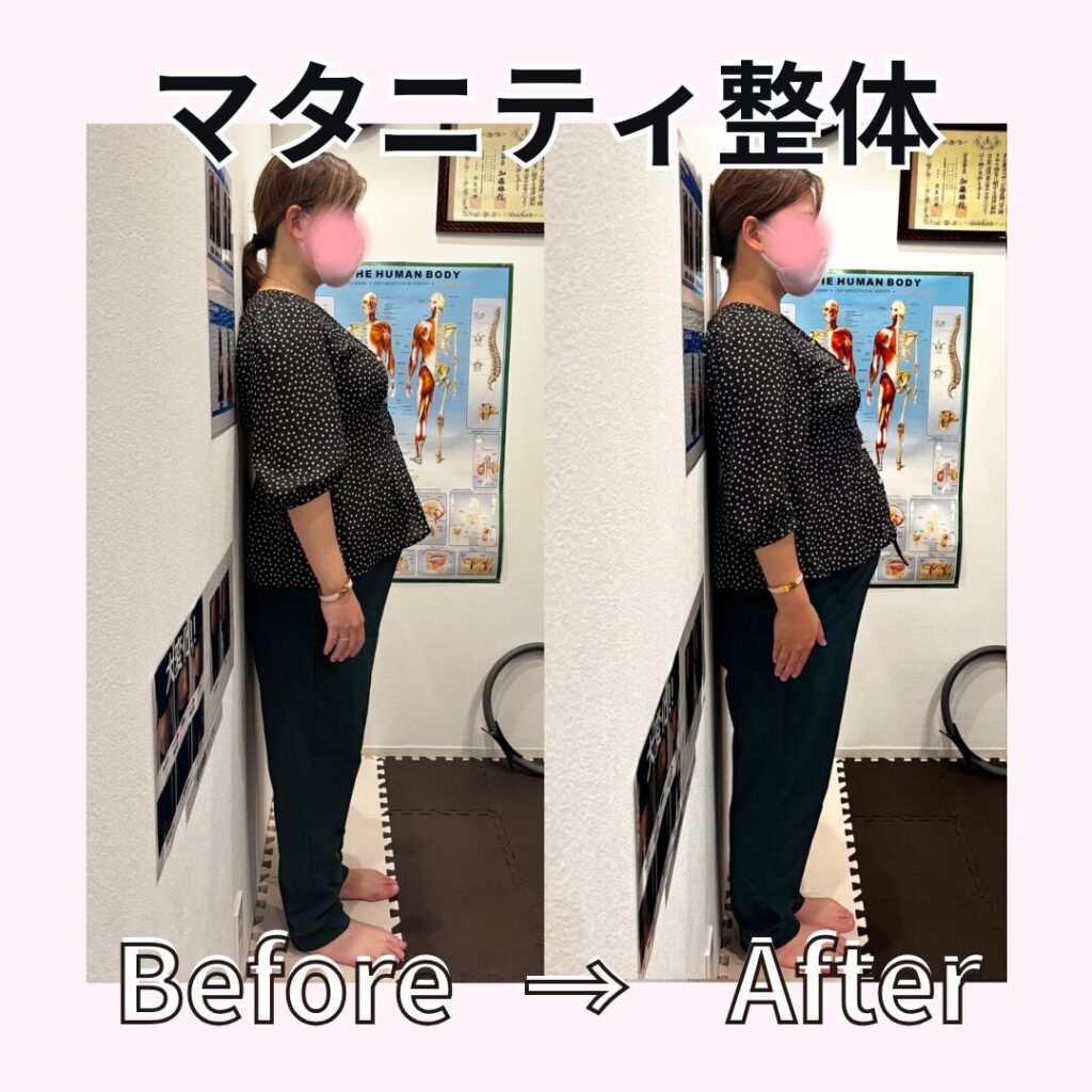 マタニティ整体ビフォーアフター