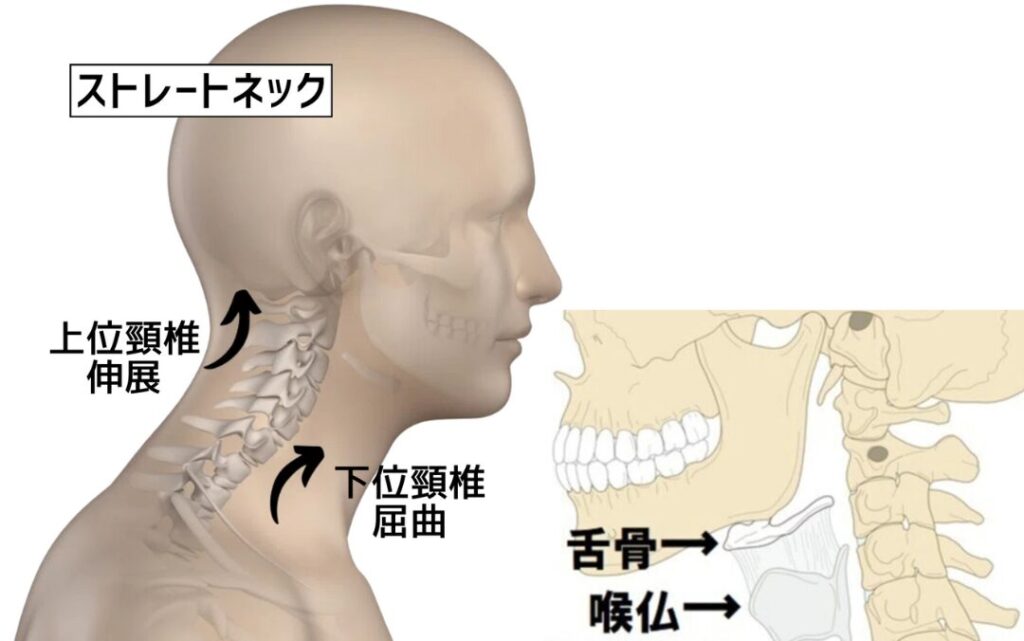 二重アゴの原因は?