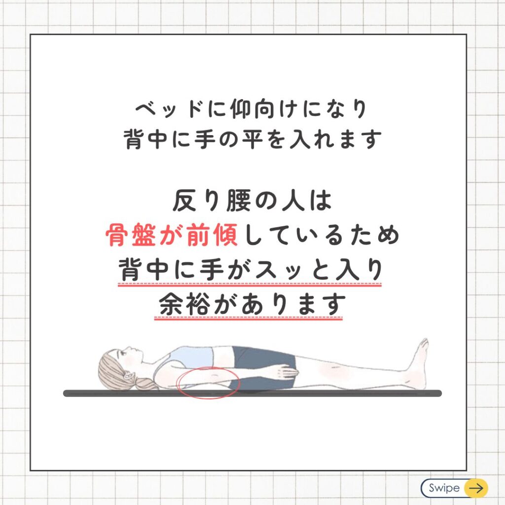 反り腰は骨盤が原因??