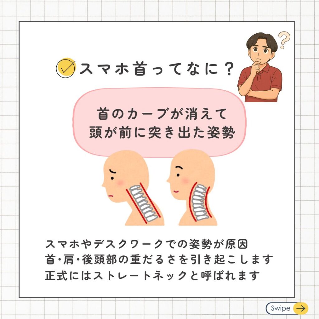 スマホ首って?
ストレートネック