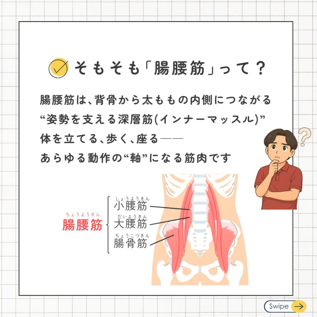 反り腰と猫背の共通点【腸腰筋のSOS】