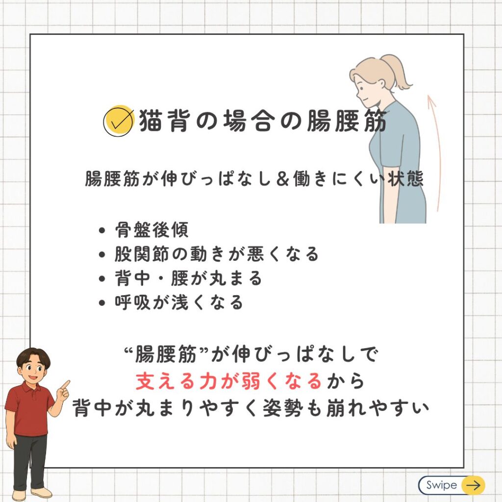 猫背の人の腸腰筋