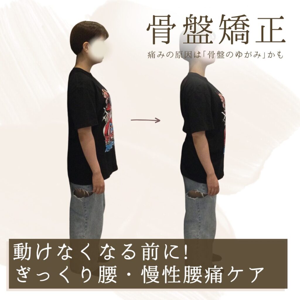 ぎっくり腰・慢性腰痛