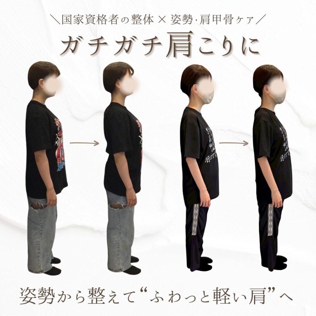 ガチガチ肩こり
姿勢・肩甲骨ケア