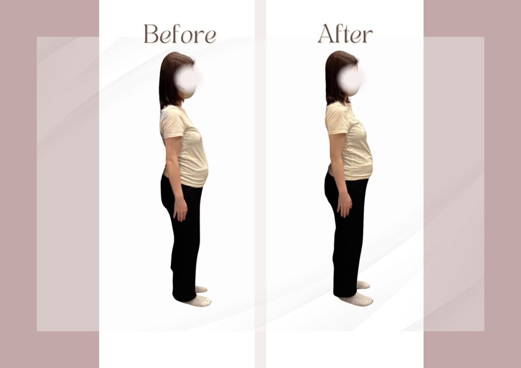 マタニティ整体ビフォーアフター
反り腰