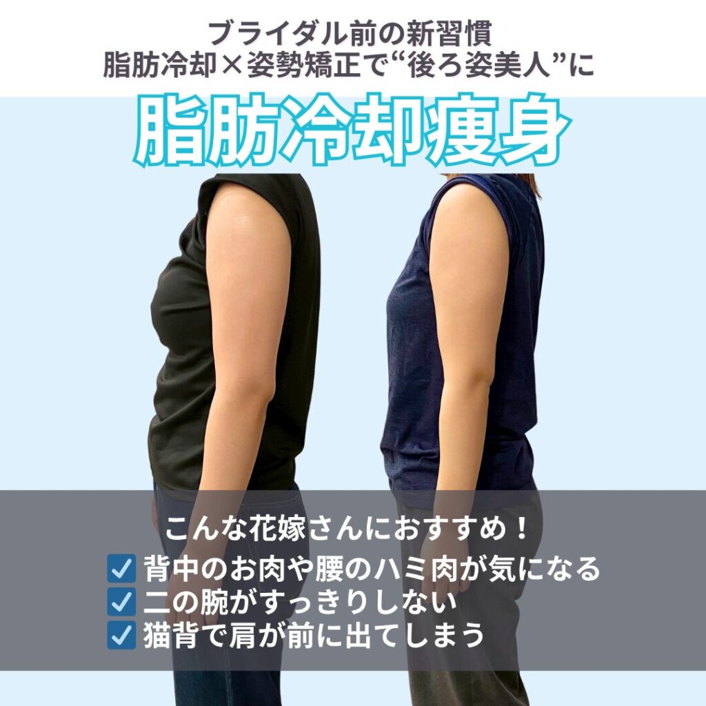 ブライダル整体
脂肪冷却
姿勢矯正