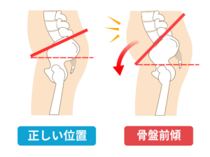 股関節
骨盤前傾